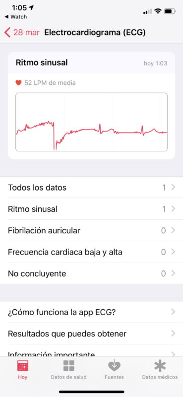 La app ECG del Apple Watch Series 4 ya está disponible en España