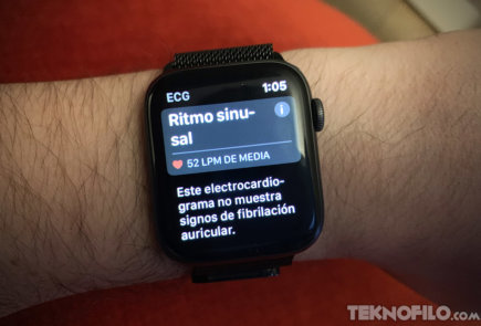 Debe habilitar la detección de caídas en su Apple Watch? - Diario Informe